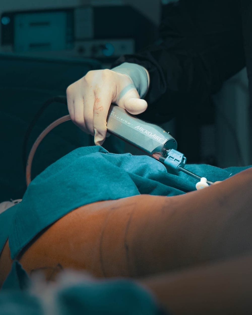 El Dr. Luciano Ríos Lara operando en el Hospital Ángeles Clínica Londres