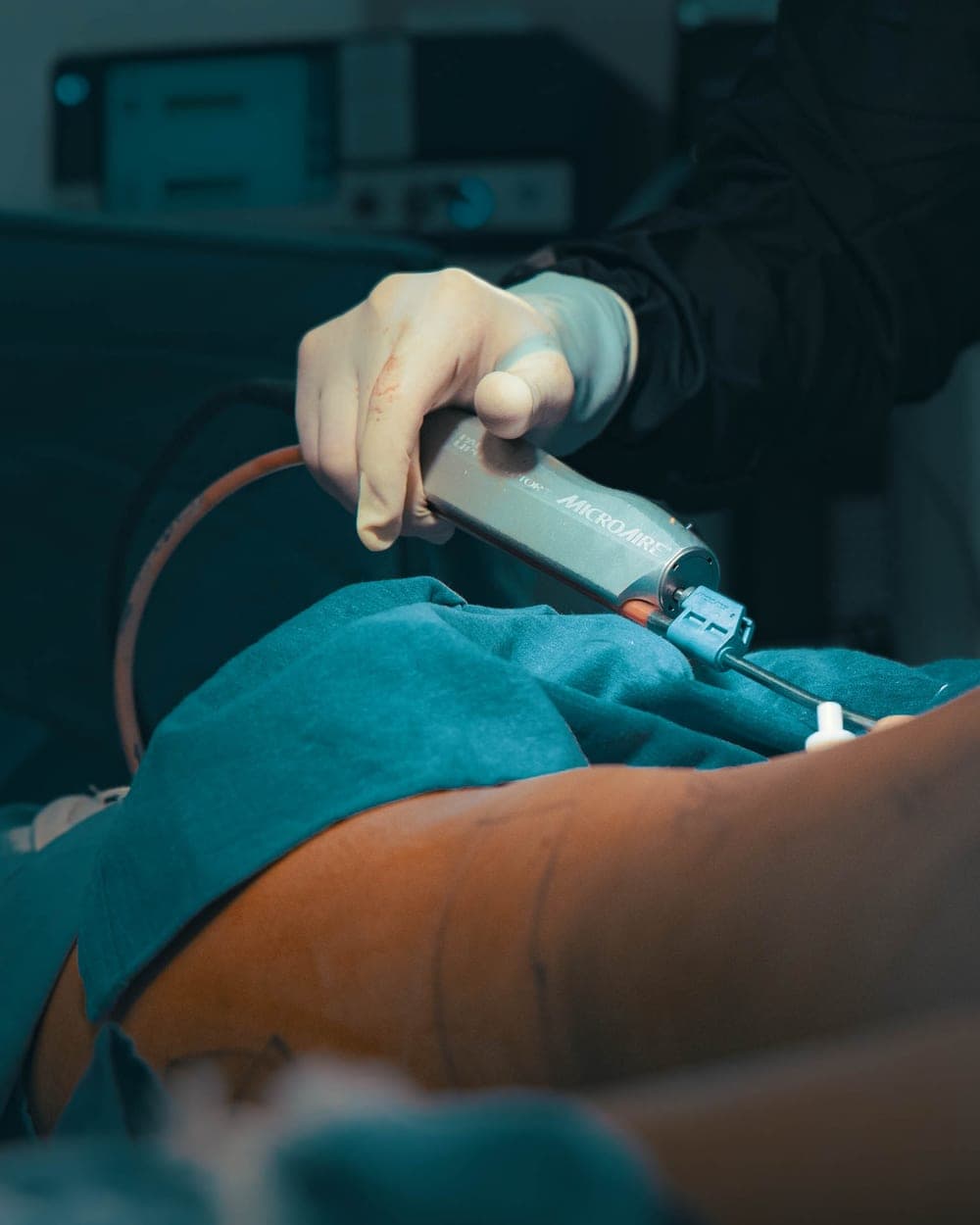 El Dr. Luciano Ríos Lara operando en el Hospital Ángeles Clínica Londres